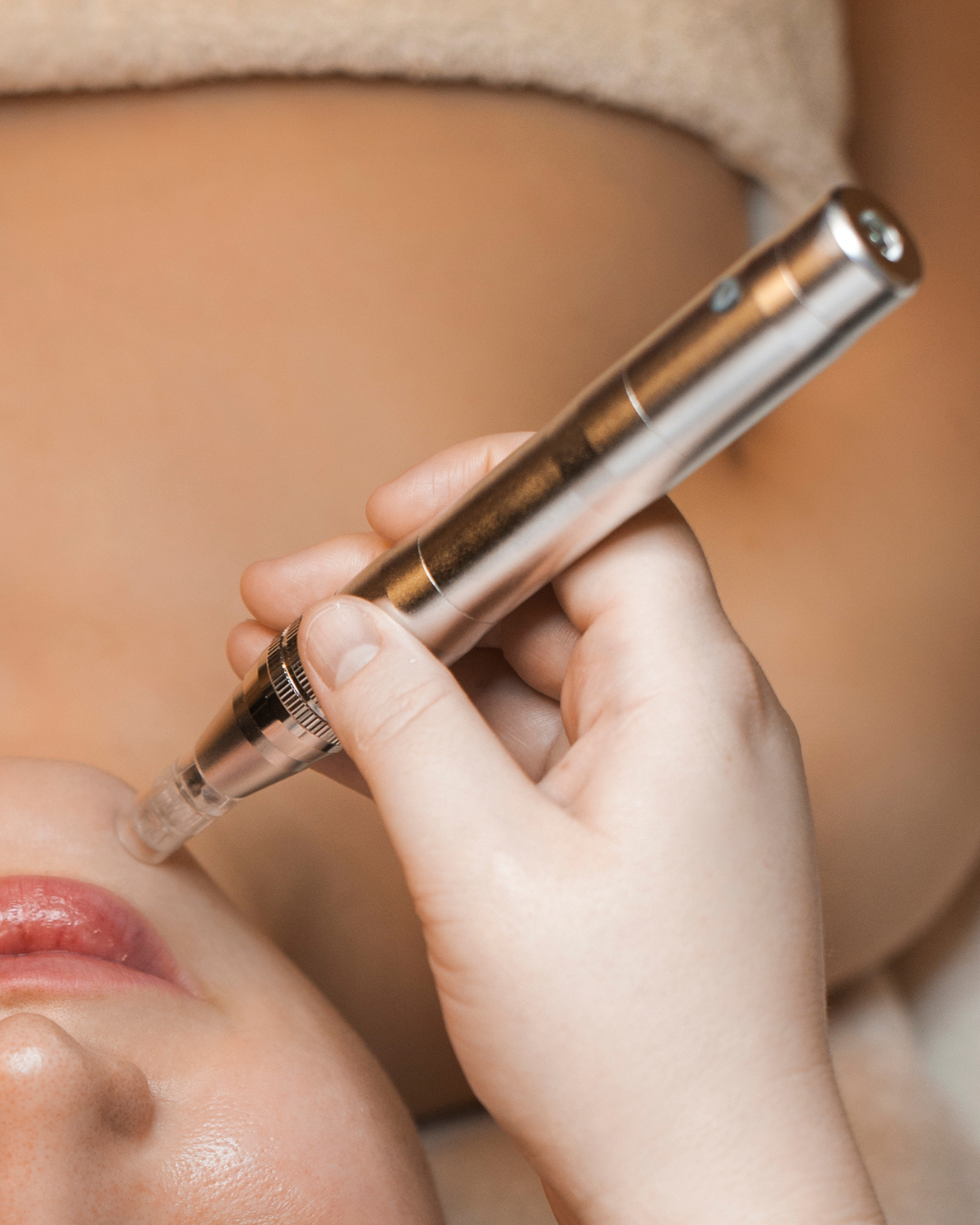 Bono 3 Sesiones · Microneedling Dermapen
